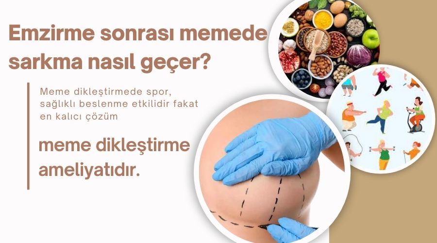 Emzirme sonrası memede sarkma nasıl geçer? - Antalya