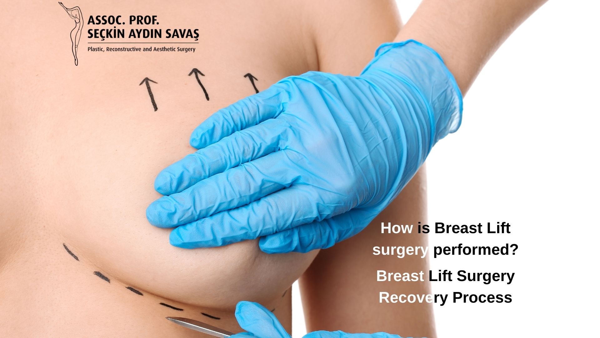 how-is-breastlift-surgery-done in turkey, antalya