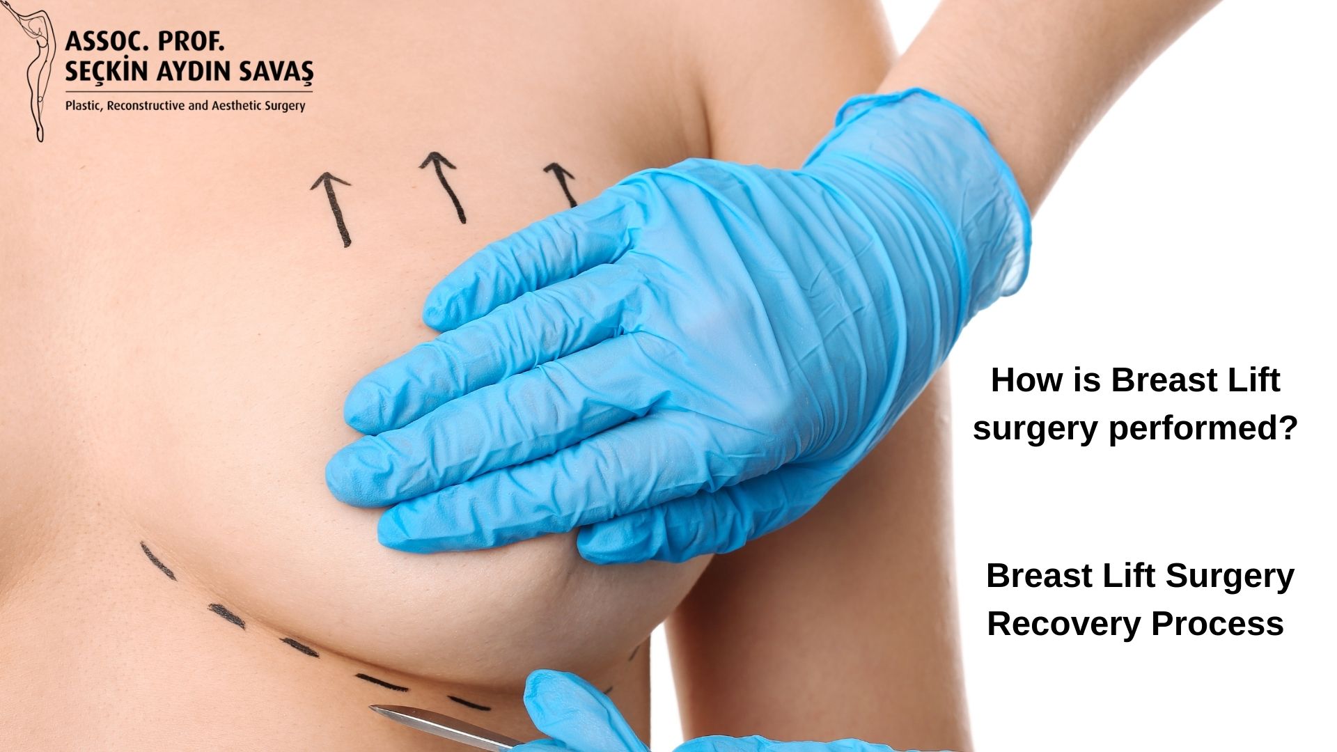 How is Breast Lift (Mastopexy) Surgery Done? Recovery after Breast Lift in turkey, antalya