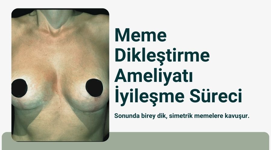 Emzirme sonrası memede sarkma Antalya