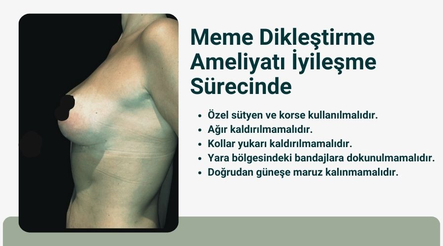 Emzirme sonrası memede sarkma Antalya