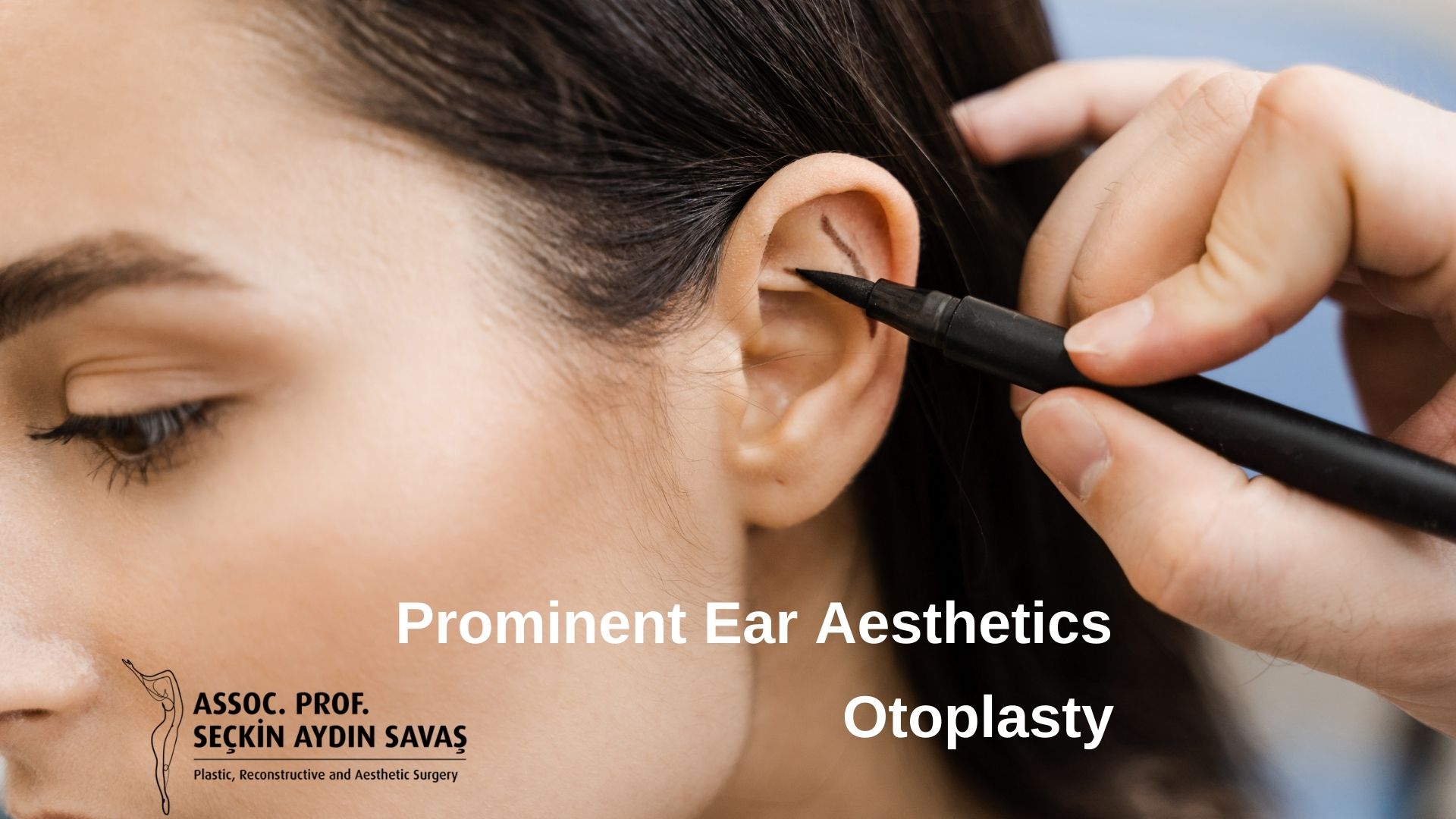 prominent-ear-aesthetics-otoplasty-turkey-antalya