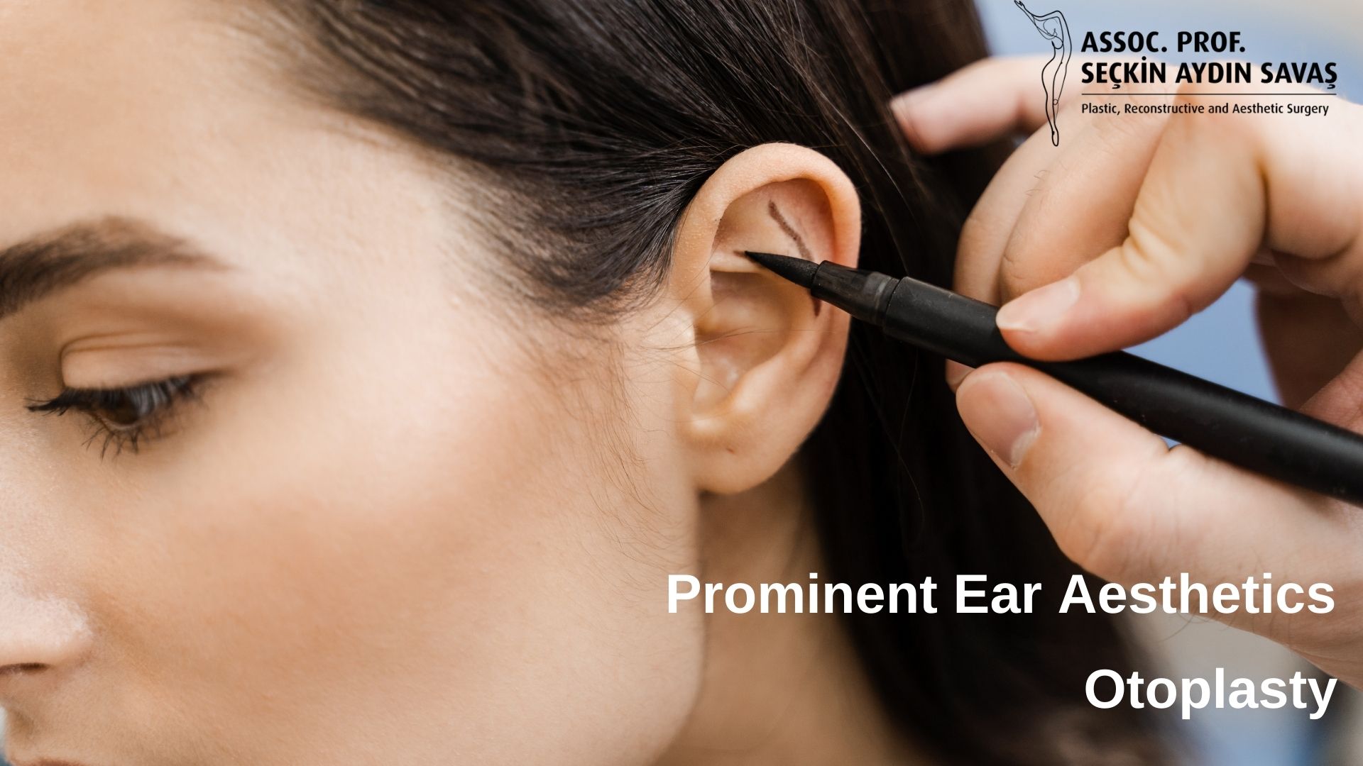 What is Prominent Ear Aesthetics? in turkey, antalya