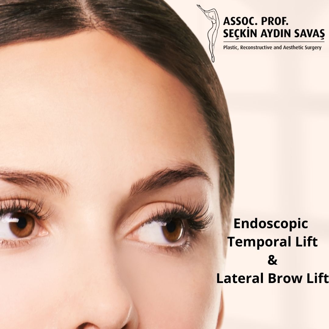 endoscopic-temporal-lift-turkey-antalya